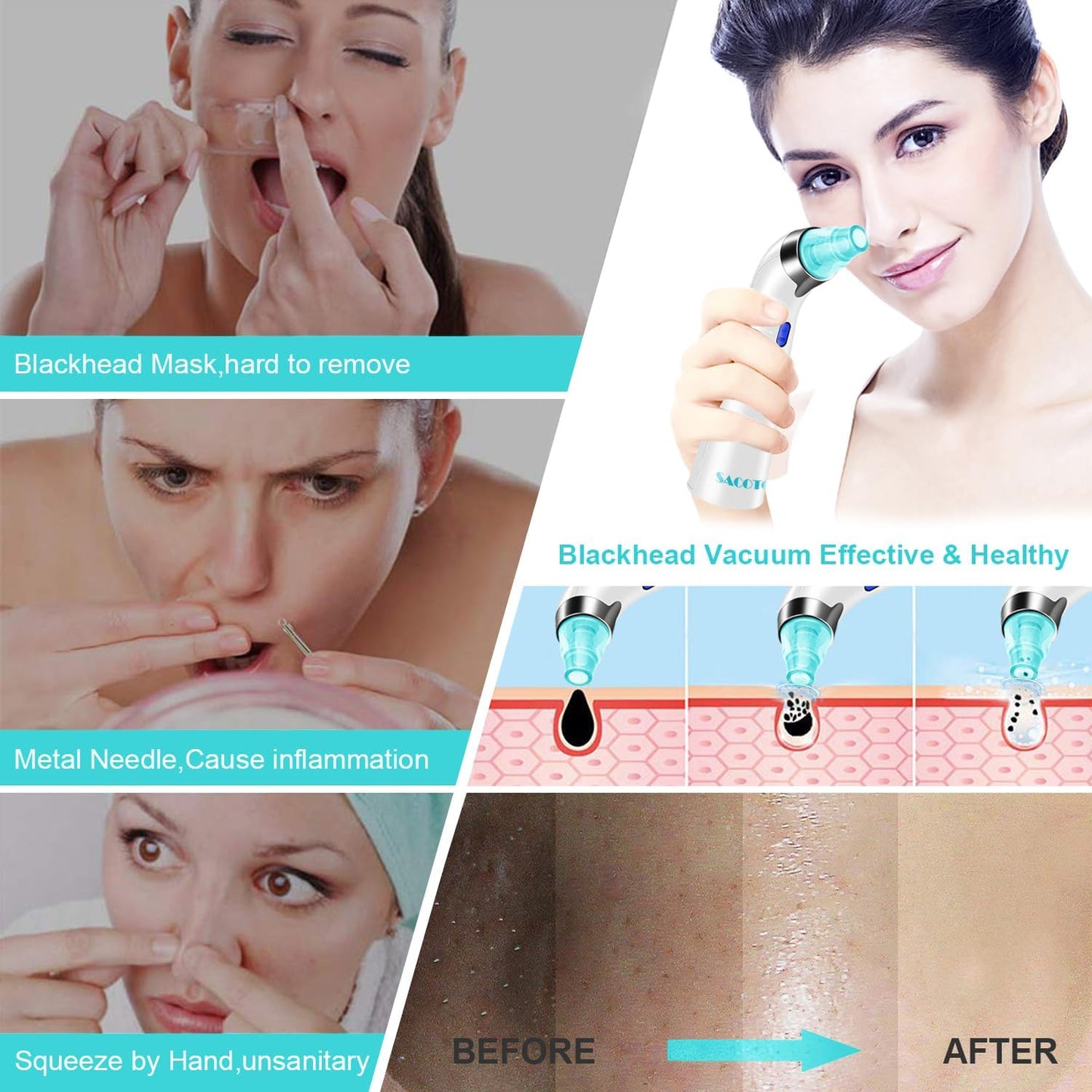 Blackhead Remover Pore Vacuum, Face Suction Pore Cleanser, 5 Suction Power Electric Blackhead Extractor Tool, 4 Probes, Blackhead Suction Remover for Women & Men