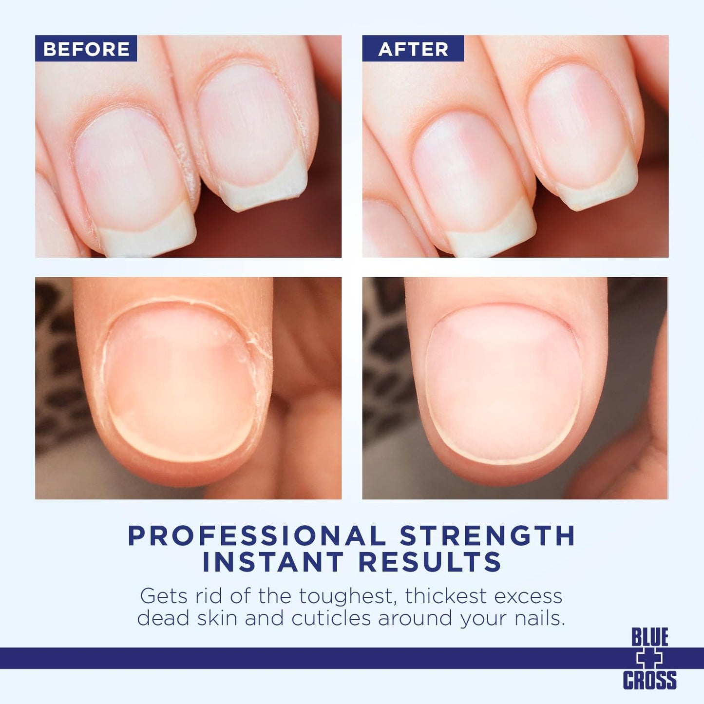 Blue Cross Cuticle Remover Liquid, Cuticle Softener for Nails, Professional Nail Care with Lanolin for Brittle Hang Nails, Hydrating, Moisturizing, Dry Cuticles, Made in USA, 8oz