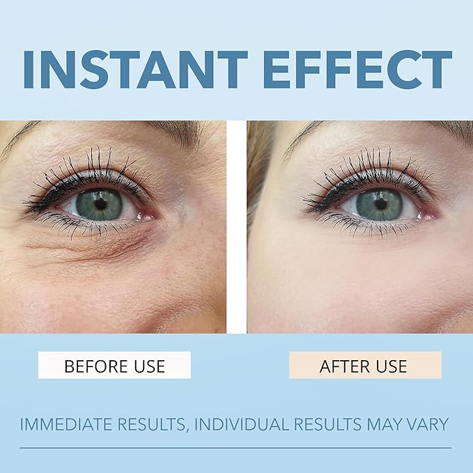 Rapid Reduction Serum For Eye - Instantly Visibly Reduces Under Eye Bags and Wrinkles, Fine Lines, Crow's Feet, and Dark Circles,Anti Aging Wrinkle Remover for Face with Pump, 10ml/0.34 Oz
