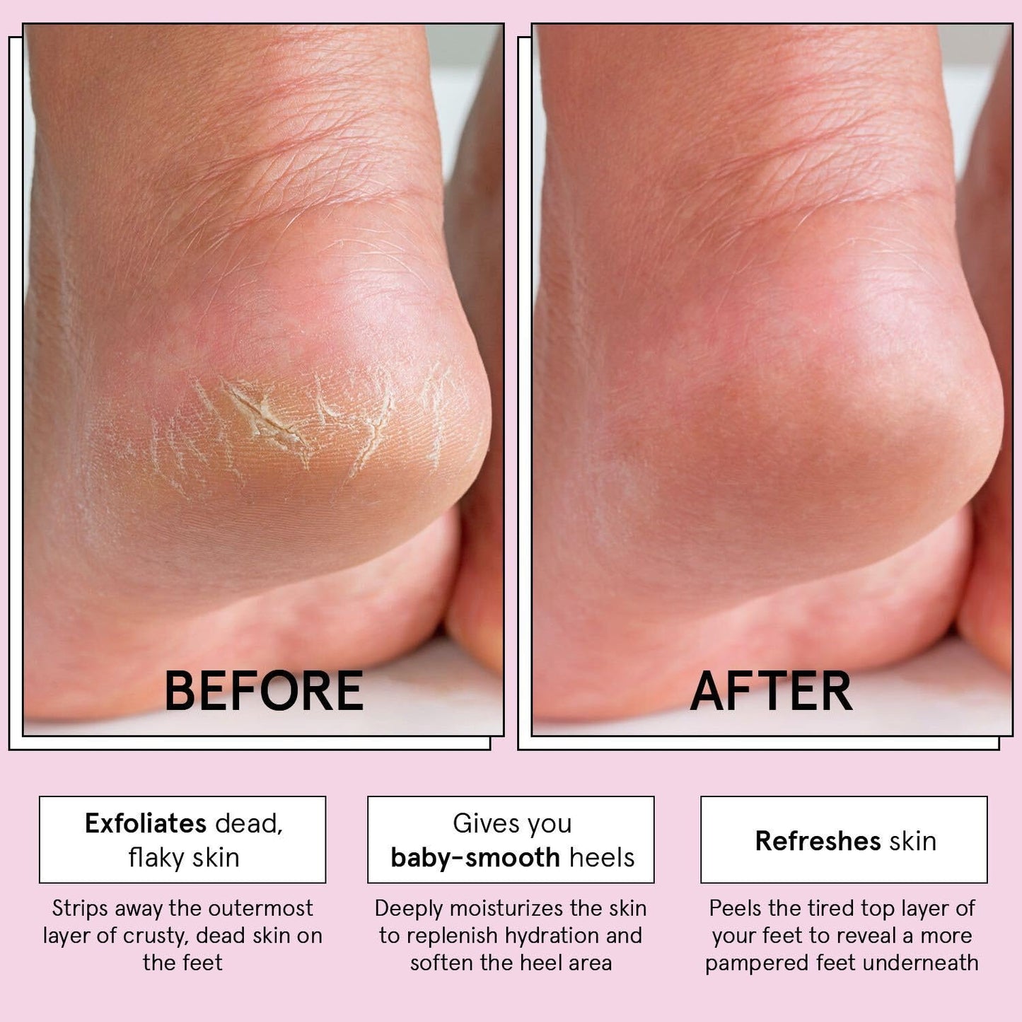 grace & stella Award-Winning Foot Peel Mask - Foot Peeling Mask with Aloe Vera - Moisturizing Foot Mask for Dry Cracked Feet - Foot Exfoliator for Baby Soft Feet (2 Pairs, Unscented)