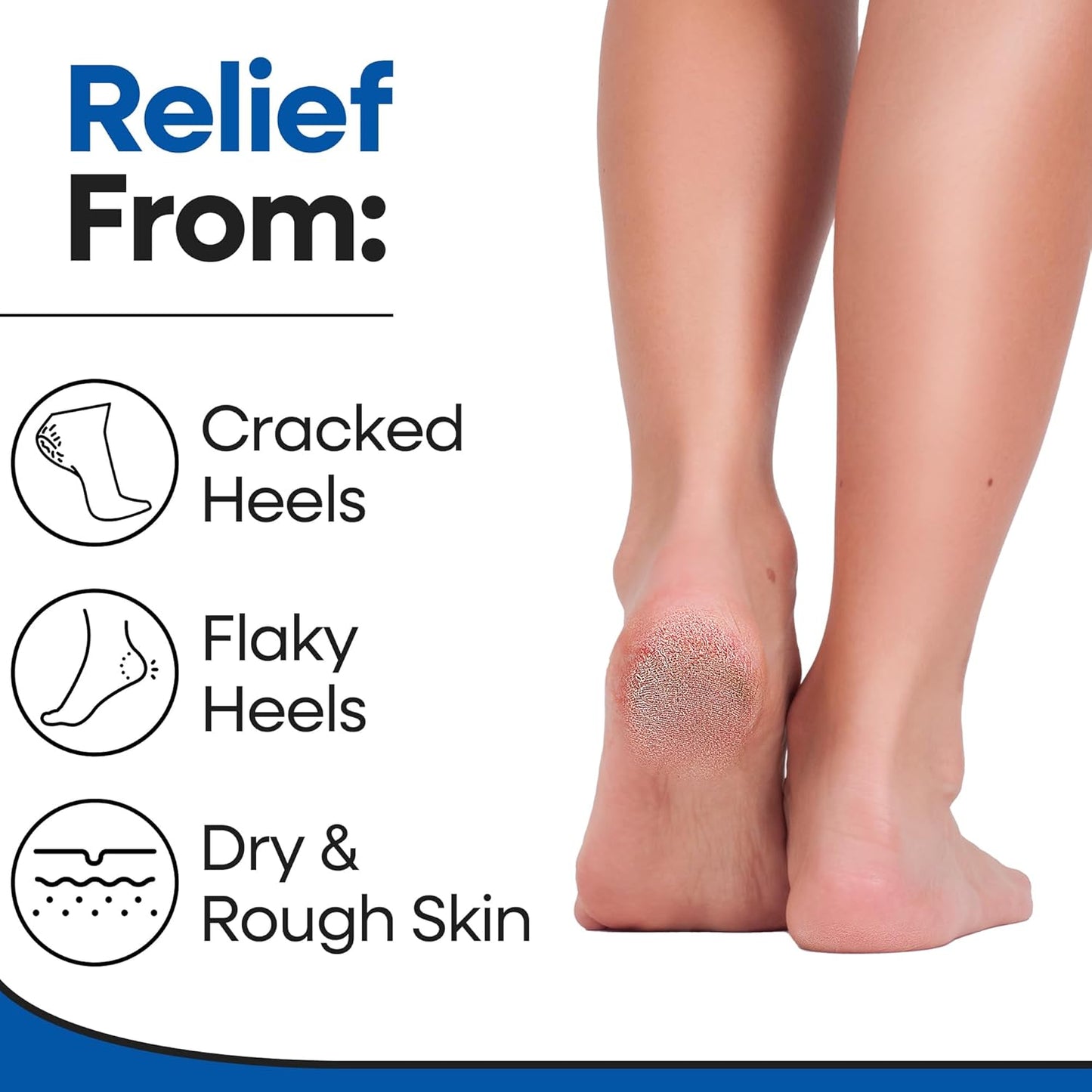 Moisturizing Socks for Men & Women | Aloe Vera Cracked Heel Treatment | Foot Callus Remover | Aloe Socks for Cracked Heels & Dry Feet | Lotion Infused Gel Heel Sleeves (Large - 2 Pairs)