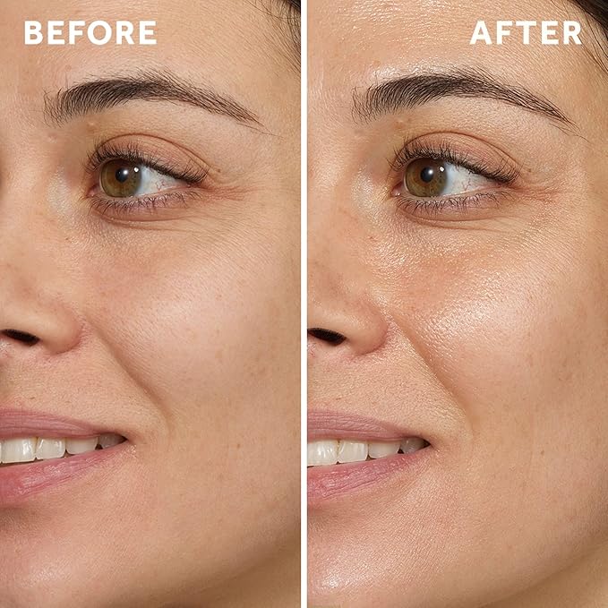 No7 HydraLuminous+ 2% Hyaluronic Acid Serum - Hydrating Facial Serum with 5% Vitamin B3 Niacinamide to Support Skin Barrier Repair - For Visibly Radiant & Healthier-Looking Skin (1 Fl Oz)